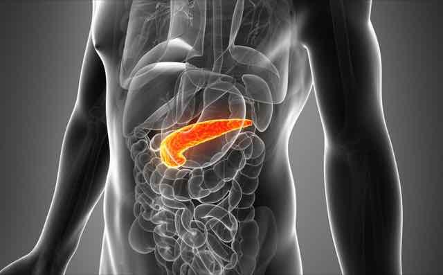Pancreatite aguda pode aumentar riscos de câncer de pâncreas