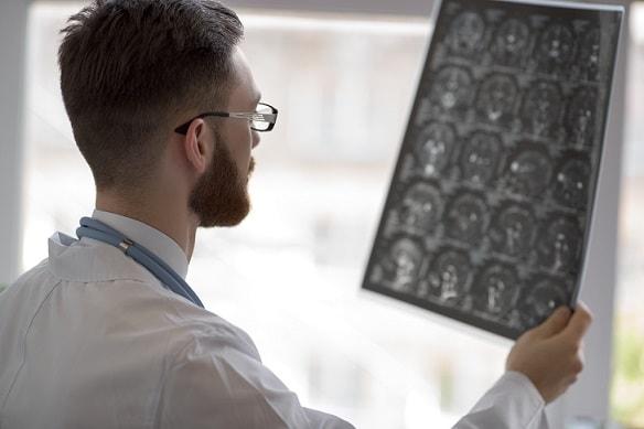 Meningite Tuberculosa: cuidados intensivos