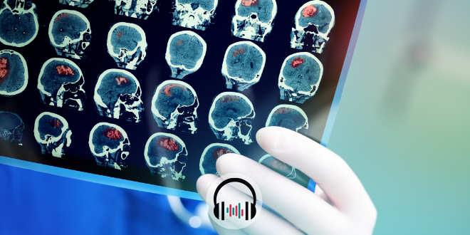 Como reconhecer e monitorizar a hipertensão intracraniana? [podcast]