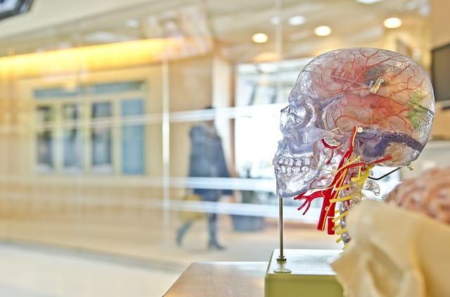 Representação de um cérebro humano que pode sofrer trombose venosa cerebral