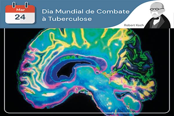 Dia Mundial da Tuberculose: tuberculose no SNC