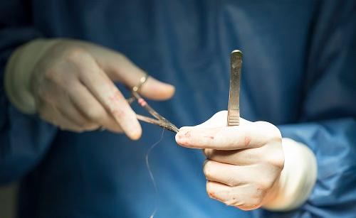 Litotripsia percutânea vs colecistectomia: qual a melhor abordagem para pacientes com alto risco cirúrgico?