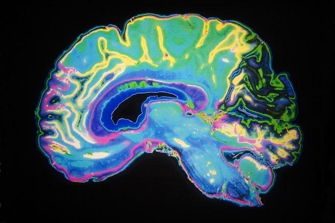 Aneurisma intracraniano não-roto: como manejar?