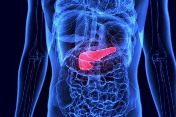 pancreatite