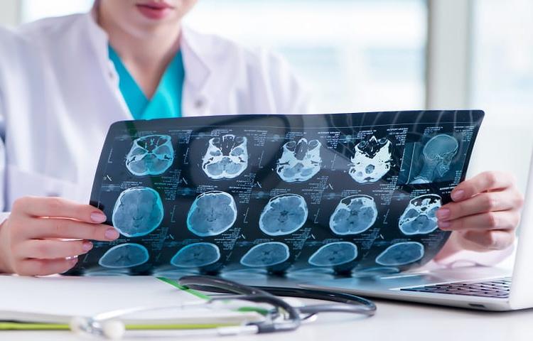 Na abordagem do status epilepticus, qual a melhor droga fenitoína ou levetiracetam