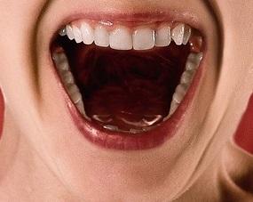 Amigdalectomia: não existe procedimento simples