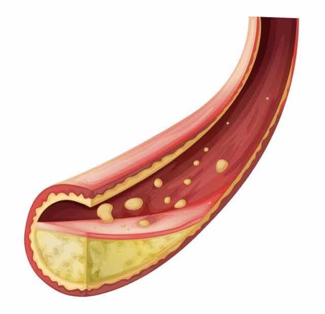 Pycnogenol: Uma nova esperança na prevenção cardiovascular