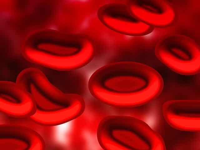 Trombocitopenia induzida por heparina: como diagnosticar e tratar?