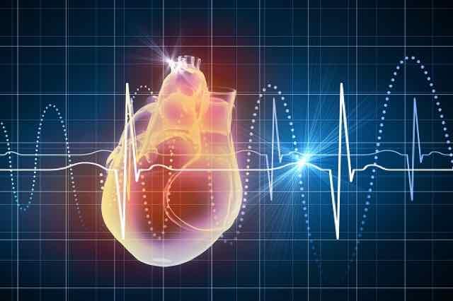 IAM com alterações de alto risco no ECG: indo além do supradesnivelamento  ST