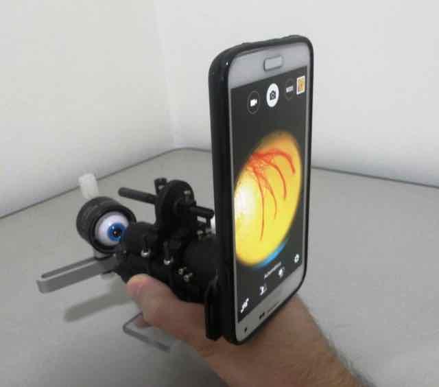 Já é possível fazer exames de retina usando um smartphone