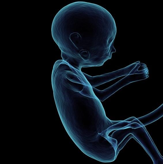 Caso raro: em cirurgia inédita no Brasil, médica queima tumor de bebê dentro do útero materno