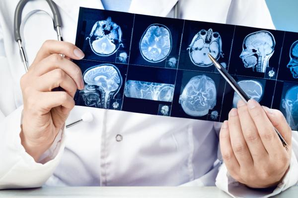 Tratamento de neoplasias cerebrais malignas