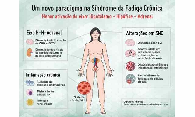 Um novo paradigma na Síndrome da Fadiga Crônica