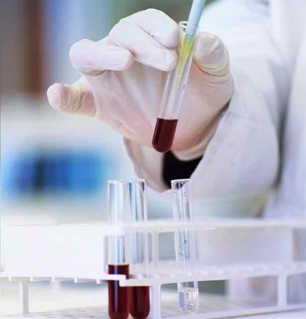 médico segurando um exame de sangue