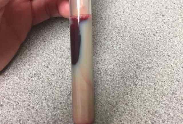 Qual o diagnóstico?