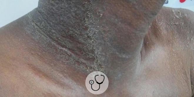 lesoes de pele caso clinico