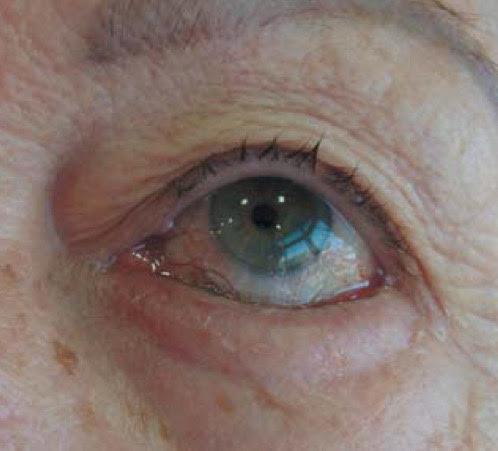 Entrópio involucional