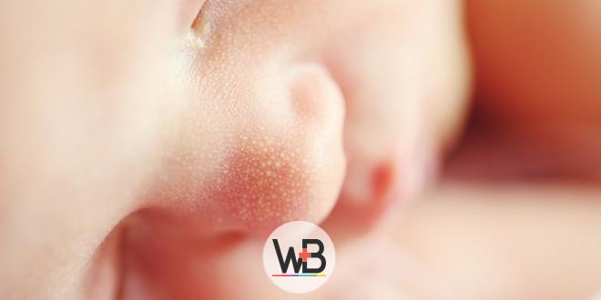 whitebook síndrome alcoólica fetal