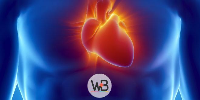 whitebook - Síndrome do QT curto