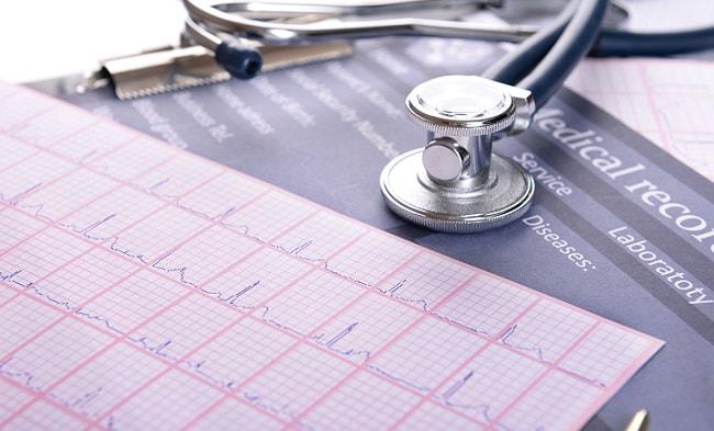 eletrocardiograma apresentando resultado de tromboembolismo e estudando o caso a partir da diretriz do esc 2019