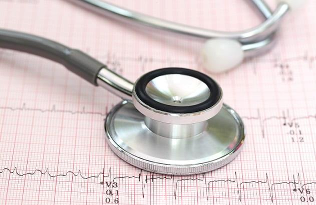 estetoscópio em cima de um eletrocardiograma de paciente com doença crônica renal