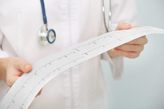 médico conferindo eletrocardiograma de paciente com flutter atrial