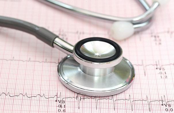 estetoscópio em cima de eletrocardiograma de paciente com pericardite aguda