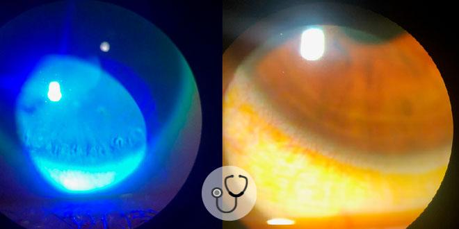 exames oculares de paciente