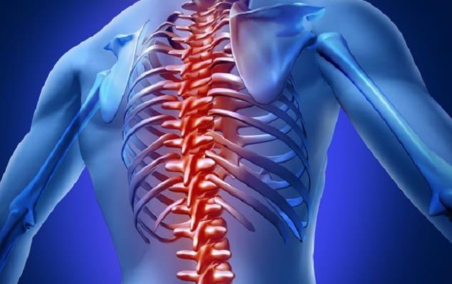 Representação gráfica de paciente com dor ciática persistente que talvez venha a passar por cirurgia.