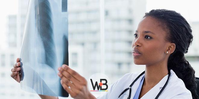 médica segurando raio-x de tórax de paciente com pneumonia por covid-19