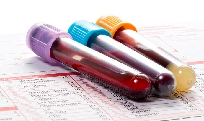 Covid-19: profissionais de saúde e agentes de segurança devem ter prioridade em testes rápidos