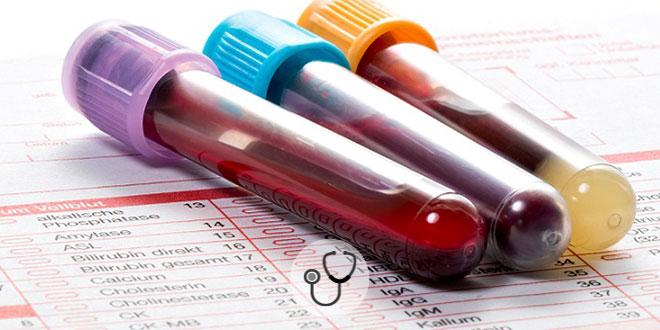 vidros de sangue de paciente com coronavírus