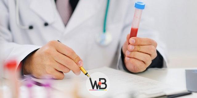 médico avaliando exame de sangue de vitamina D