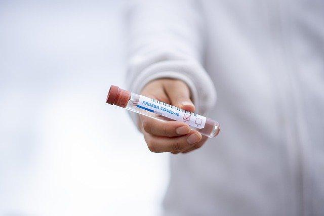 profissional de saúde segurando teste para covid-19