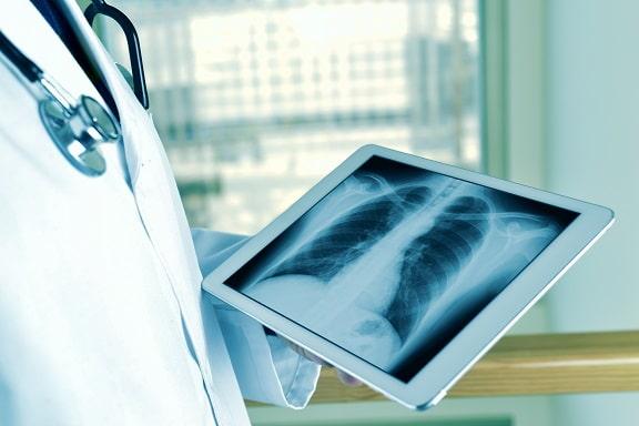 Médico olhando radiografia da plataforma RadVid-19