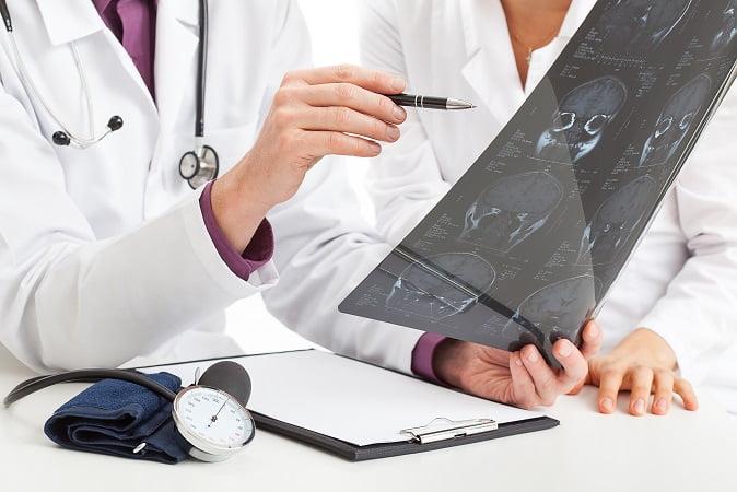 médico avaliando tomografia de paciente com hidrocefalia de pressão normal