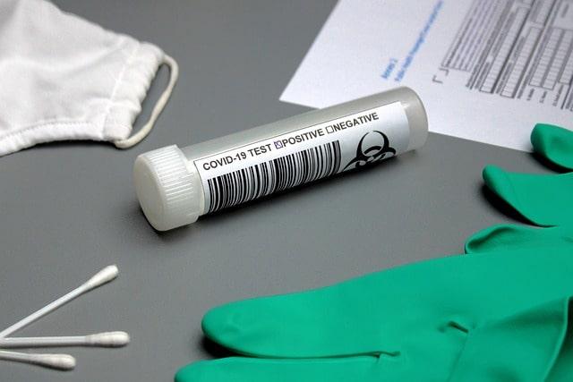 Campanha realiza testagem para Covid-19 em áreas carentes