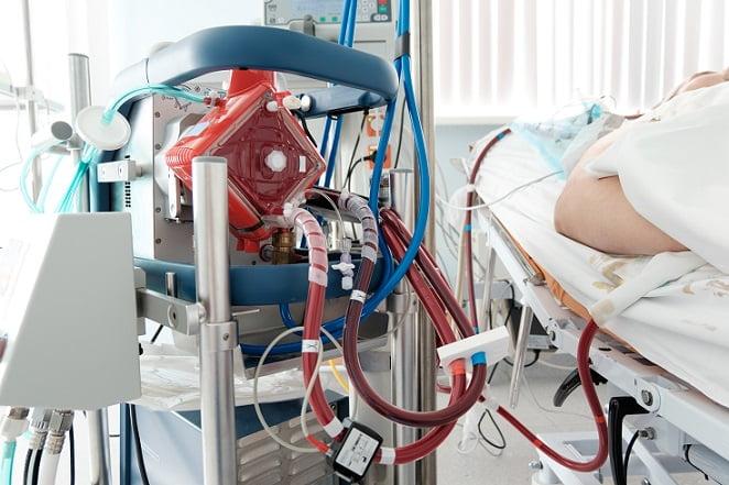 aparelho de ECMO usado em paciente com covid-19