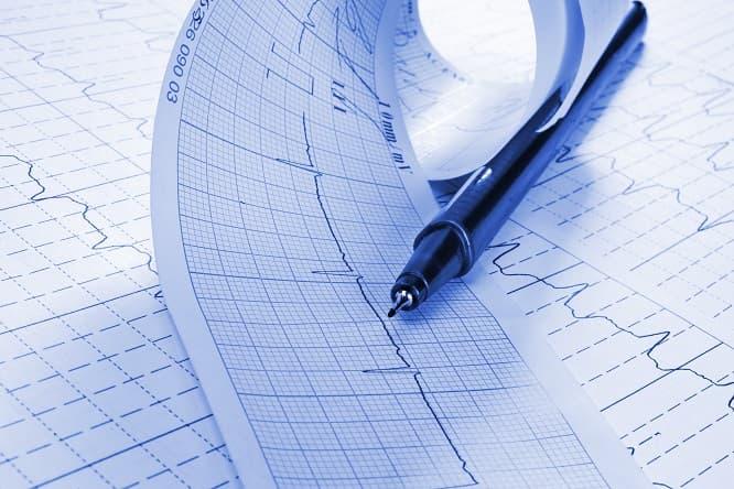 folha de eletorcardiograma de paciente em uso de prasugrel