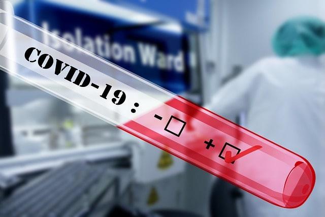 Teste para Covid-19 a fim de medir o índice de contaminação