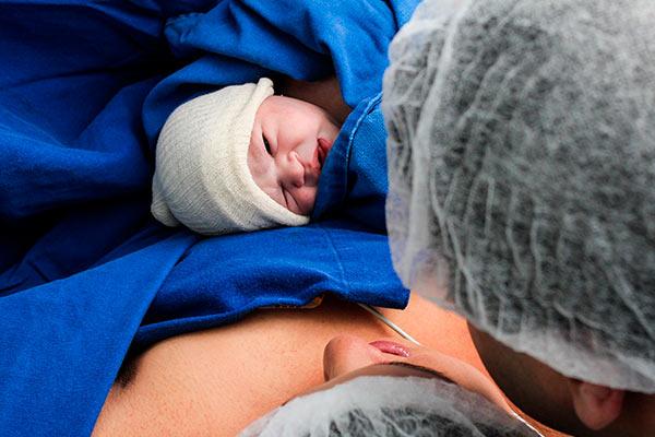 clampeamento do cordão umbilical