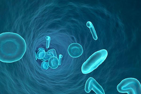 Leucemia mieloide crônica