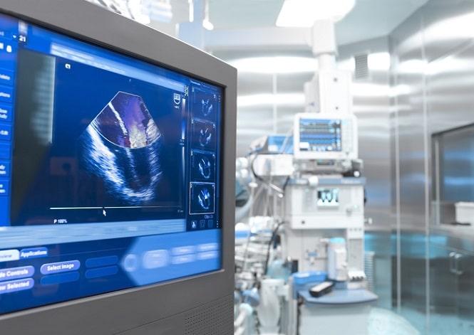 imagem de ecocardiograma de paciente com cardiomiopatia hipertrófica