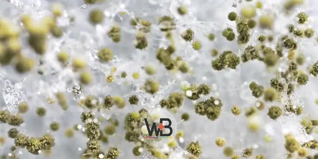 Em nossa publicação semanal de conteúdos do Whitebook Clinical Decision vamos falar sobre a apresentação clínica da mucormicose.