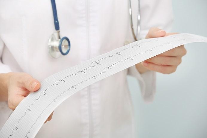 médico segurando eletrocardiograma de paciente em uso de finerenone