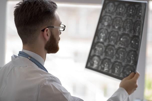 médico avaliando tomografia de paciente com avc de artéria basilar