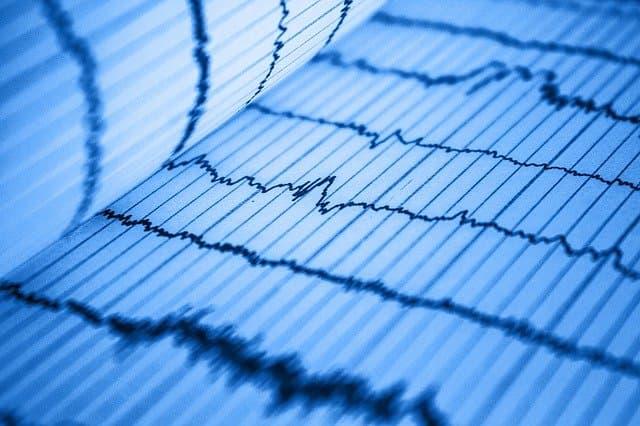 Estratificação de risco de arritmias ventriculares e morte súbita na cardiomiopatia dilatada