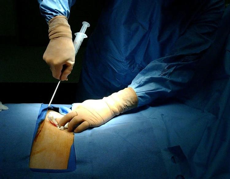 Ministério da Saúde altera idade limite para cadastro de doadores de medula óssea