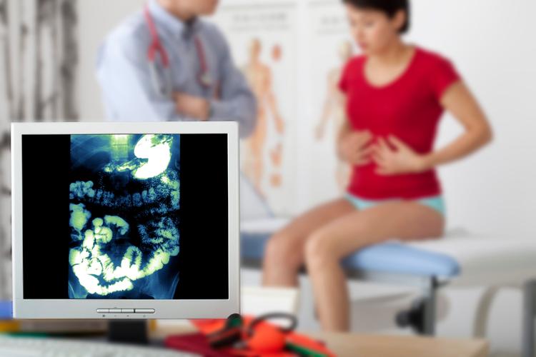 Anticolinérgicos na síndrome do intestino irritável