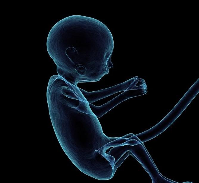 Oclusão endoscópica traqueal fetal